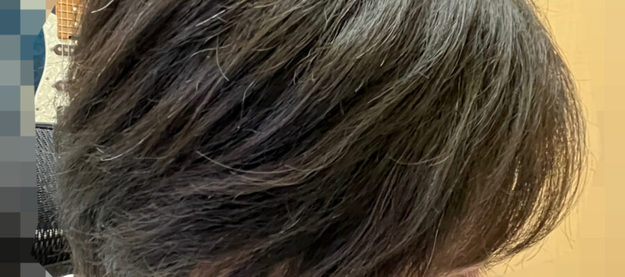 頭皮マッサージでくせ毛を治す。長期観察記録22ヵ月の写真です（サイド部分）