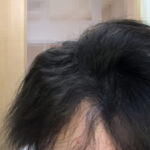 頭皮マッサージでくせ毛を治す。長期観察記録５か月目（地毛の割合が増えてウネウネしてる）