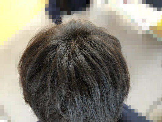頭皮マッサージを開始してから七ヶ月経過した写真です。ホホバオイルとワックスでセットした写真です。