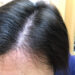 頭皮マッサージを初めて3か月経過しました。全然直毛ではないものの、クセが柔らかくなってきた感があります。